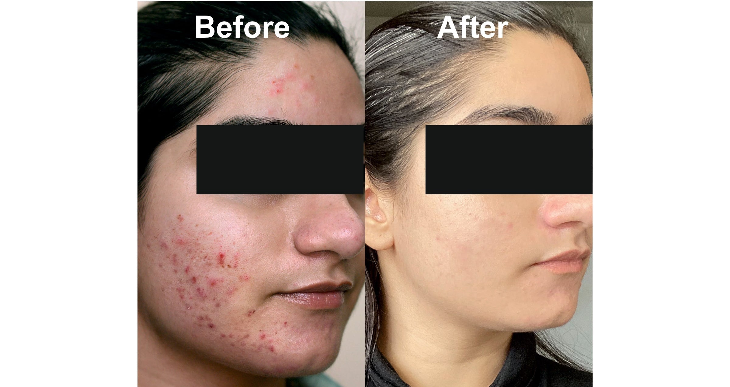 Glamycose Face Glow Cream